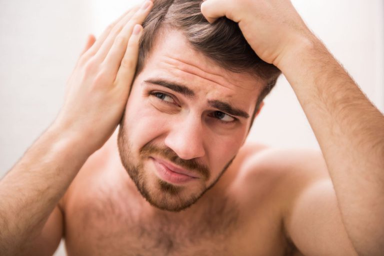Männer Mit Diesem Merkmal Neigen Eher Zu Haarausfall 3982